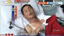 Foot long finger thick iron rod penetrates through worker's arm