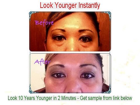 Linda Lutz Reviews (Dermatologist in Baltimore)