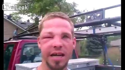 Bee/Wasp sting compilation