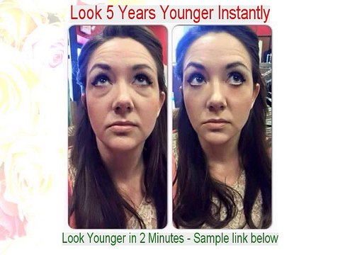 Caroline S. Wilkel Reviews (Dermatologist in E Greenwich)