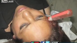 Woman From Peru Survives A Screw Driver Attack!