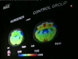 Cerebro violento: Cortex prefrontal (Adrian Raine)