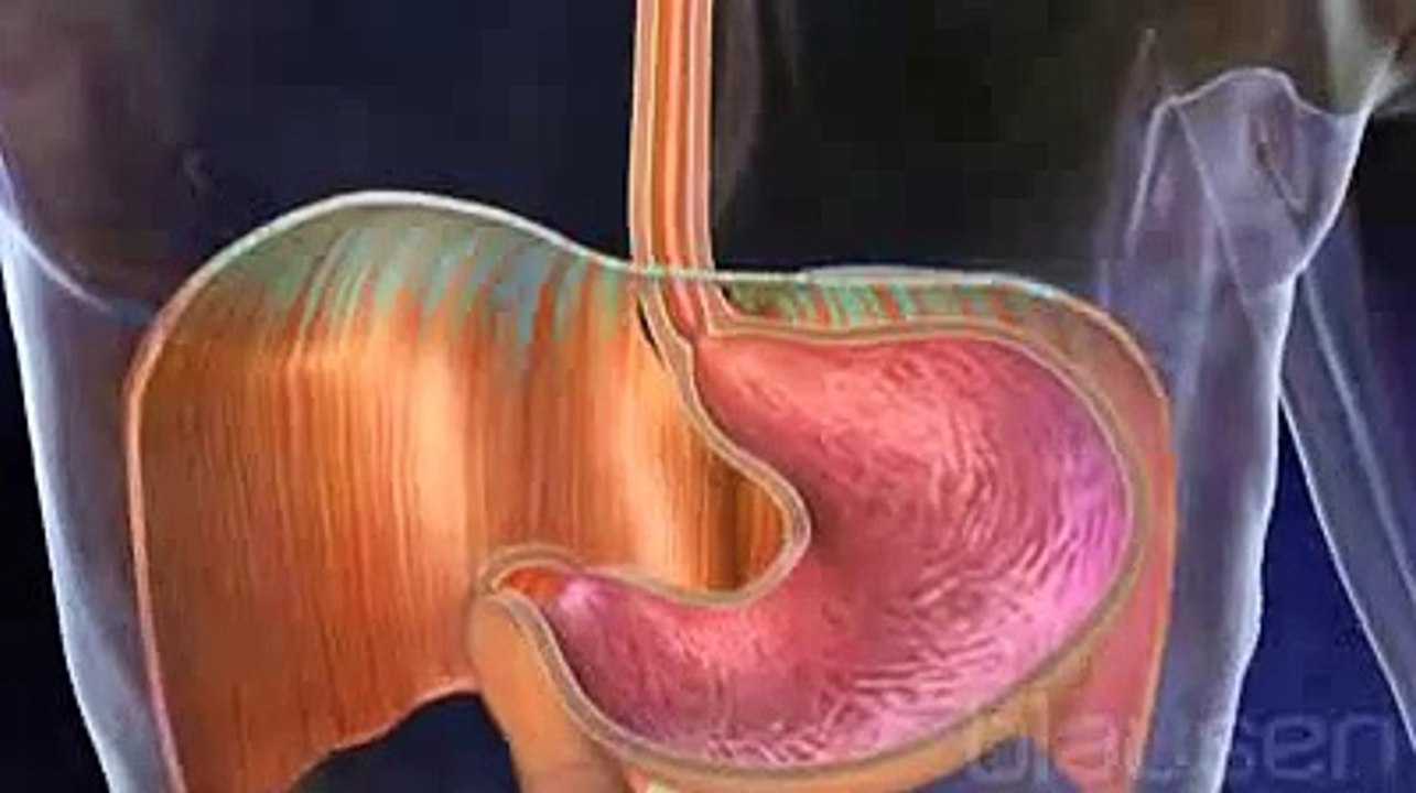 Digestion : la hernie hiatale