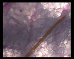 Une piqûre de moustique vue au microscope