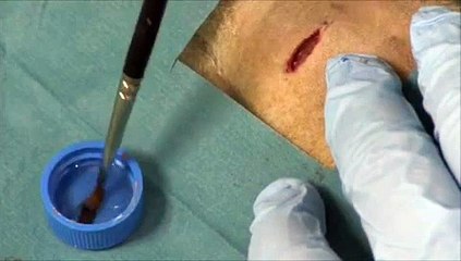 Vidéo : une colle révolutionnaire pour réparer les organes