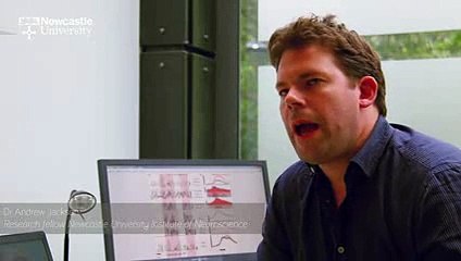 AVC :  Comment des chercheurs ont restauré la fonction d'une main paralysée