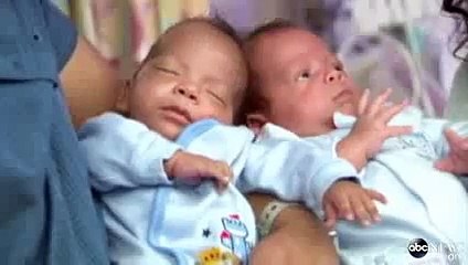 Jumeaux, ils sont nés à 24 jours d'écart