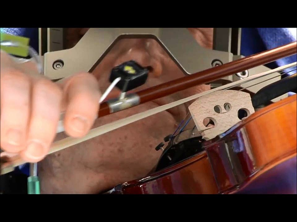 Il joue du violon pendant son opération du cerveau