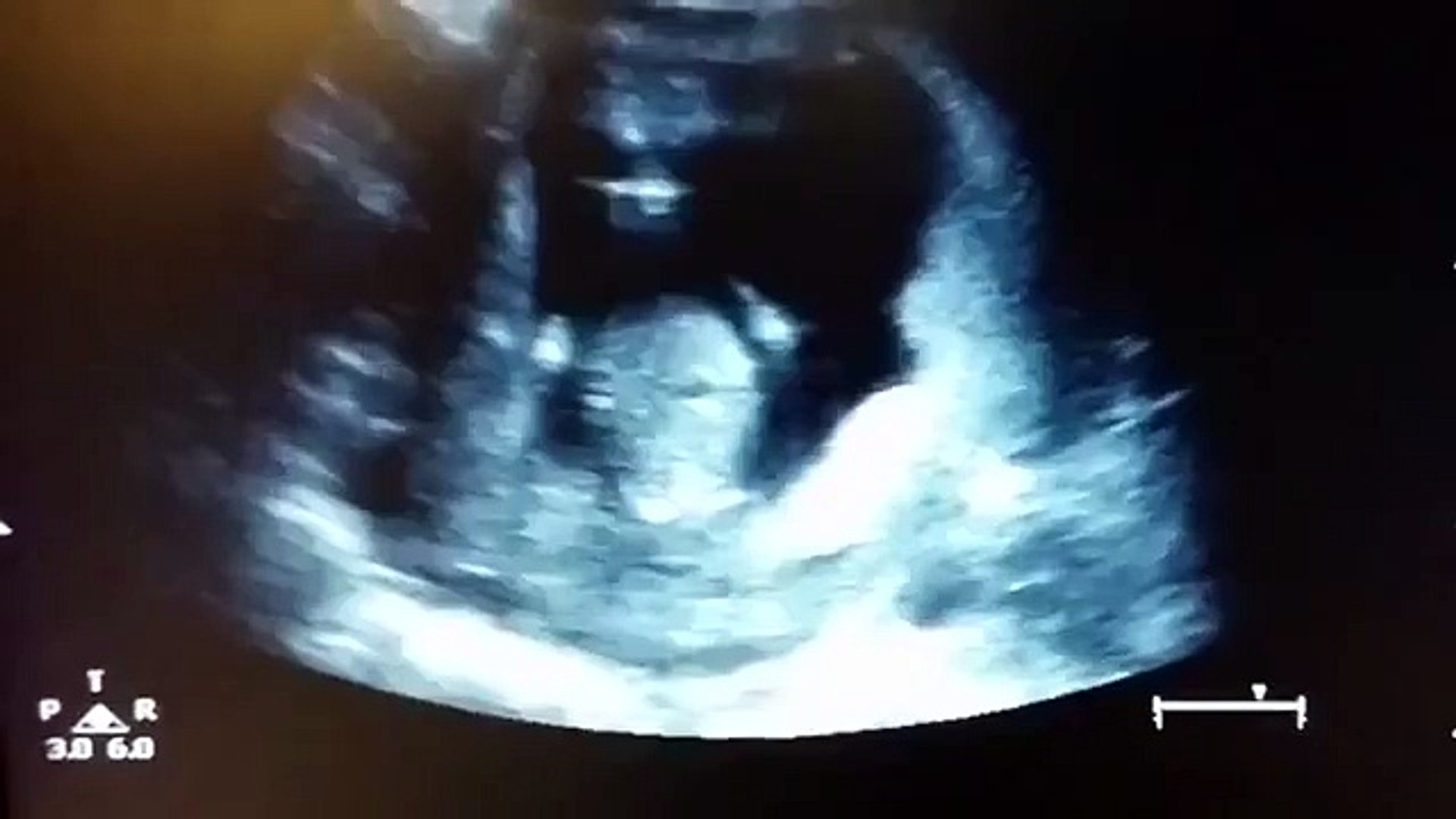 Video Ce Bebe Tape Dans Ses Mains Quand Ses Parents Chantent Video Dailymotion