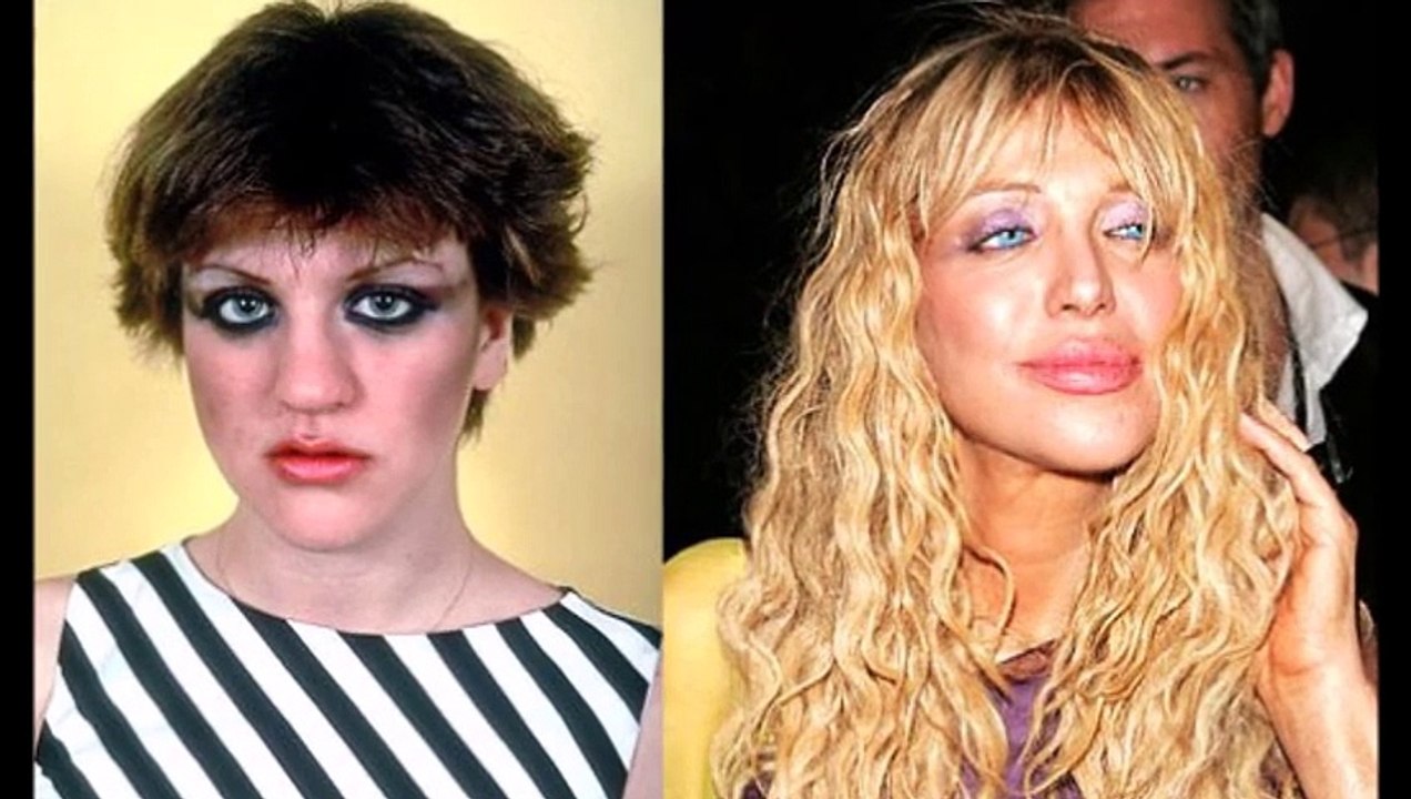 celebrities with amazing  plastic surgery
