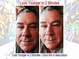 Peter B. Milburn Reviews (Dermatology in NY)