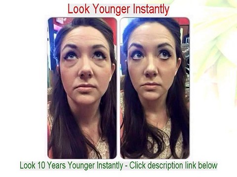 Linda K. Franks Reviews (Dermatologist in New York)