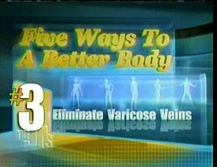 The Best Varicose Veins Doctors Are Here!