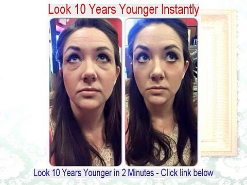 A. Raja Bhupathy Reviews (Dermatologist in Yorba Linda)