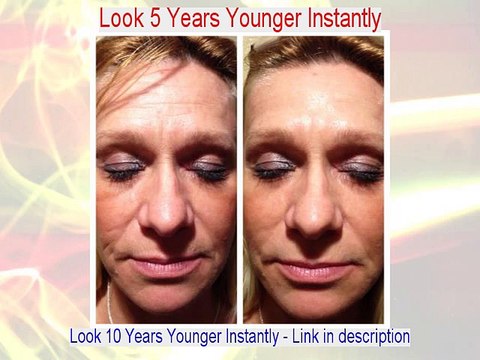 Jeffrey M. Weinberg Reviews (Dermatologist in NY)