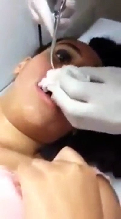 Girl Has a Giant Worm Larvae Extracted From Her Lip