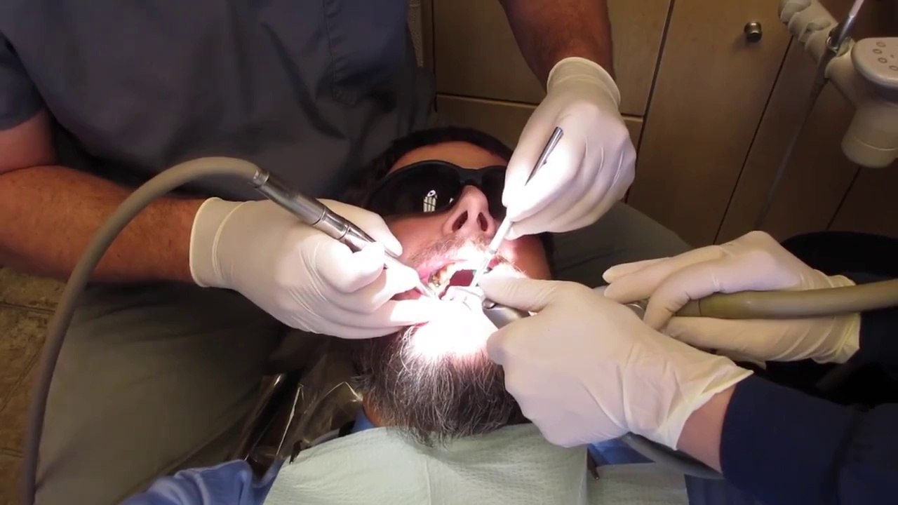 Broken Tooth - Crown Prep Part 1