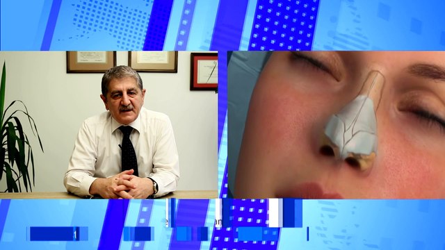 Op. Dr. Veli Aslan - Rinoplasti Nedir?