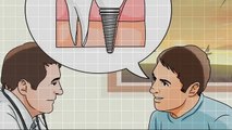 Delhi Dentist Implant Top Invisible Orthodontic with Latest Lingual Braces in Delhi