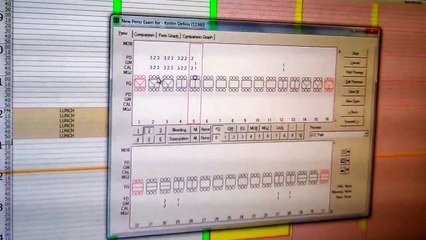 Dental Check up Periodontal Charting