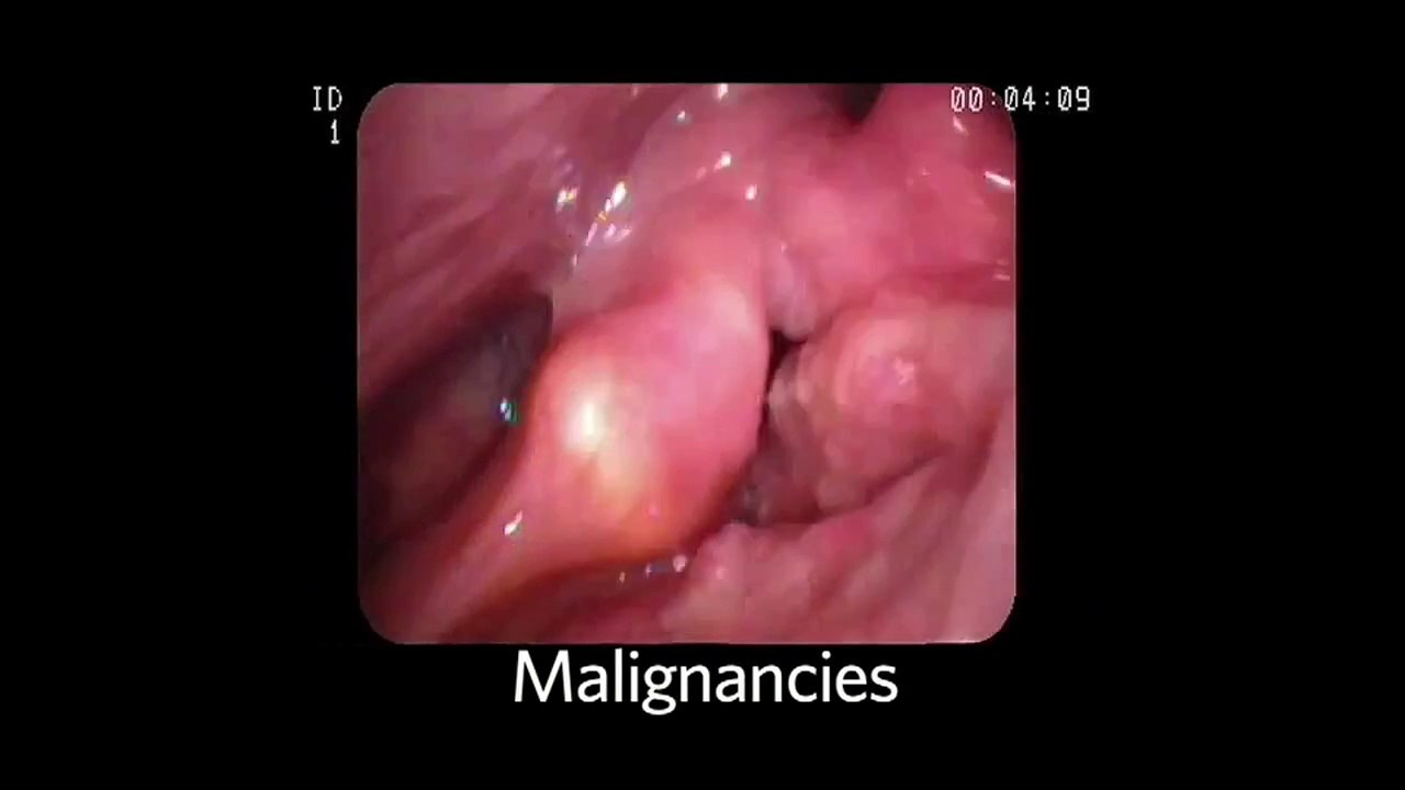 4. The Nasopharynx and Larynx Exam