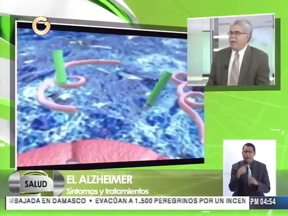 Conozca las distintas formas de demencia