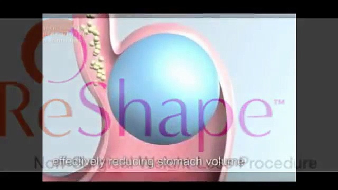 stomach balloon weight loss