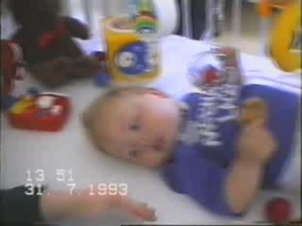 Broken Leg