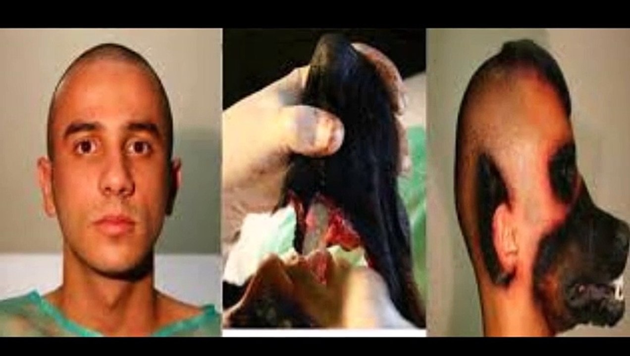 Unbelievable plastic surgery