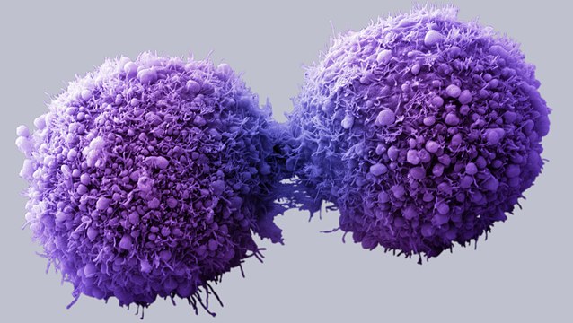 Using Precision Medicine to Target Cancer Cells