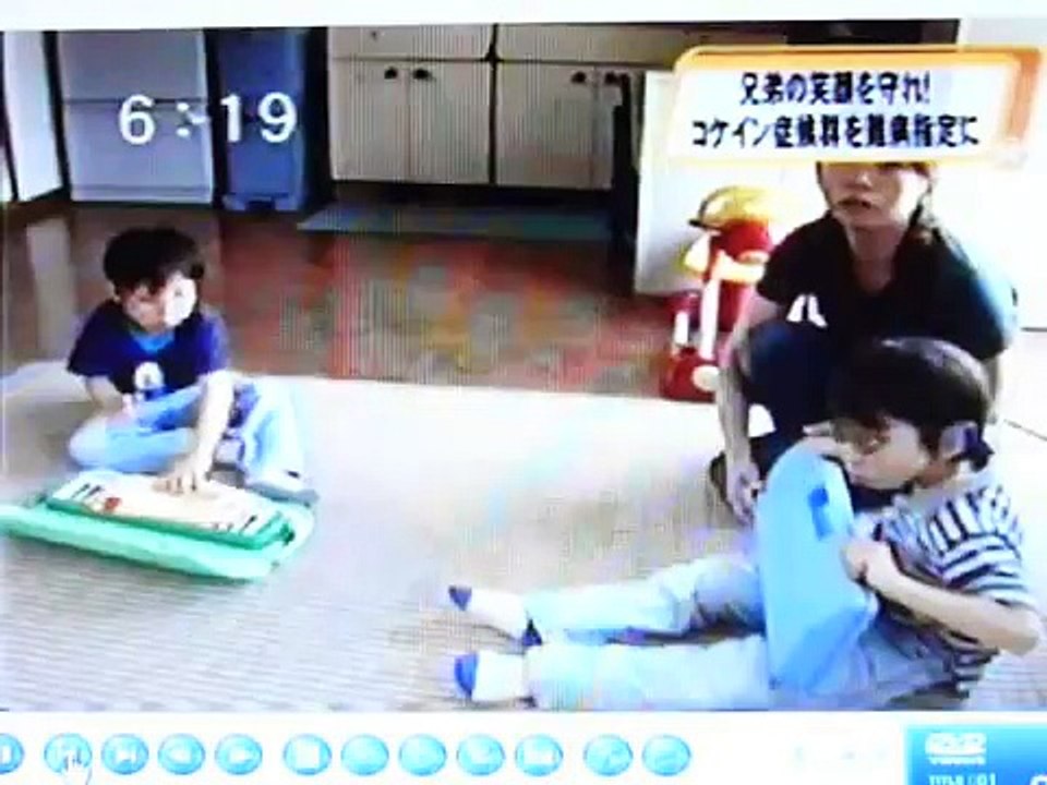 コケイン症候群