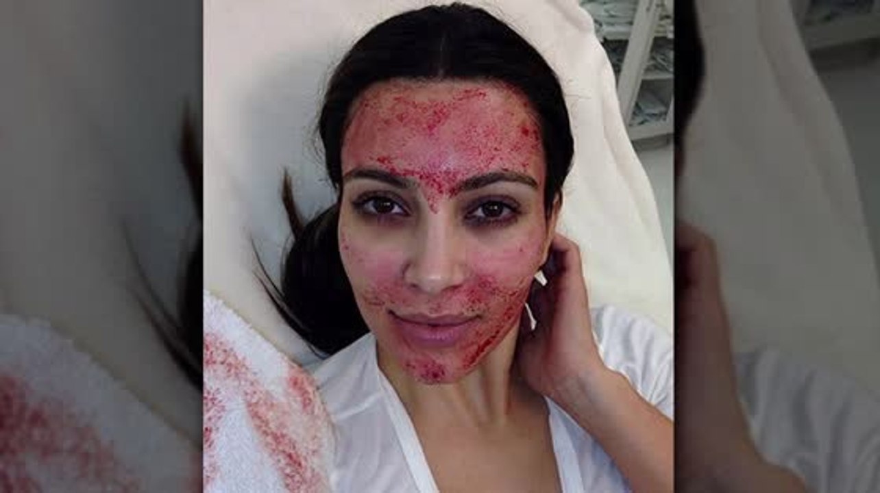 Découvrez les 5 soins de stars les plus bizarres