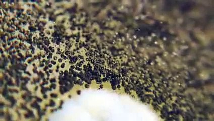 Etonnant : la moisissure vue au microscope !