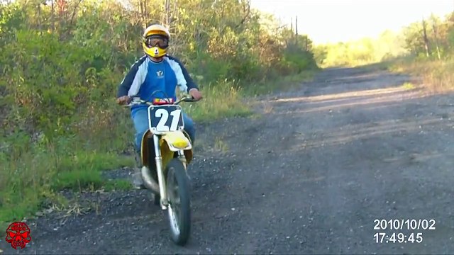 Dirt Bike Crashes Broken Bones !!!