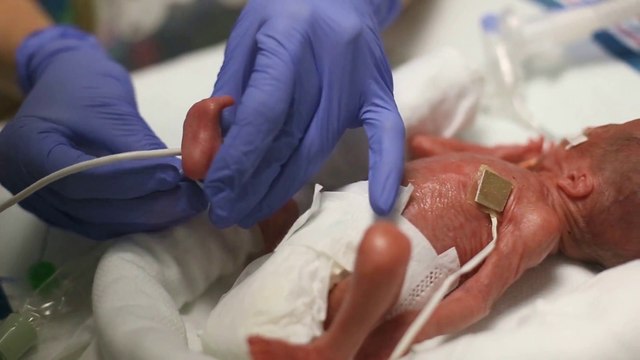 Dad celebrates 3mo premature Baby 1yo birthday! So cute!!