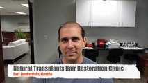 Hair Transplant Before and After -best hair transplants