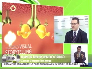 Diagnóstico temprano es clave en tumores neuroendocrinos