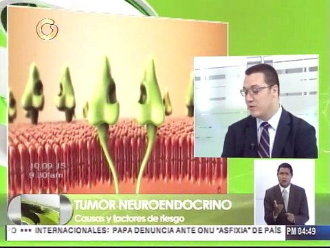 Conozca el tratamiento para tumores neuroendocrinos