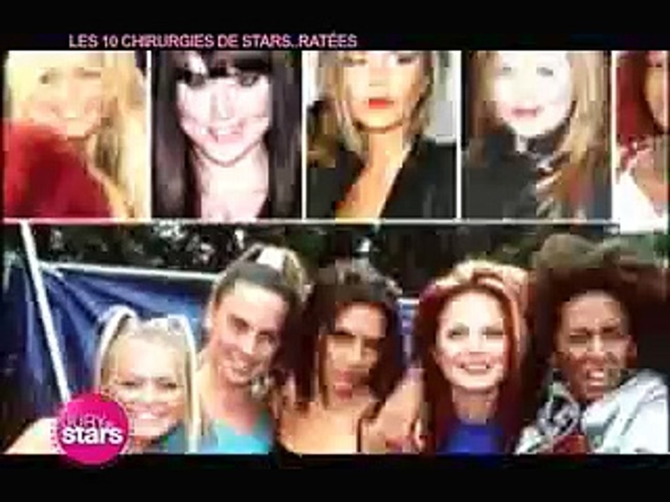 Chirurgie de stars râtée , Victoria Beckam
