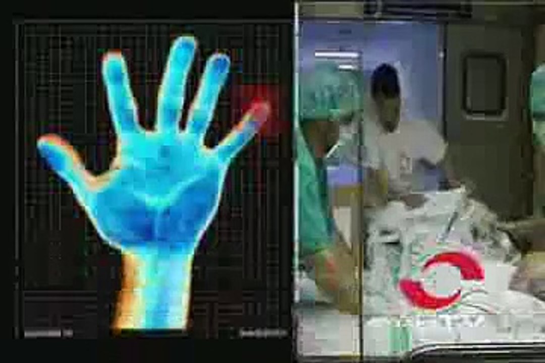 Juanetes (Hallux Valgus) - ¿Qué es y cómo tratarlos?