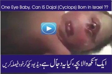 One Eye Baby Born in Israel ! Is it Dajjal?