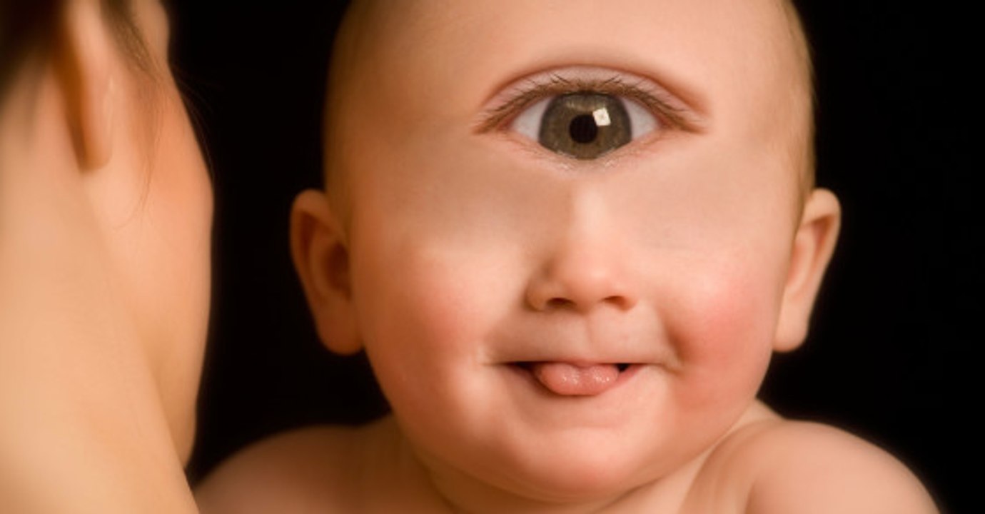 A kid born with one eye