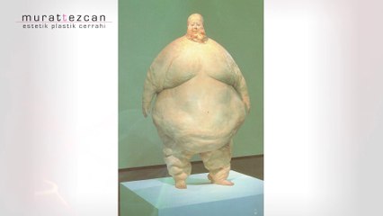 Liposuction - Bursa Estetik ( DR. Murat TEZCAN )