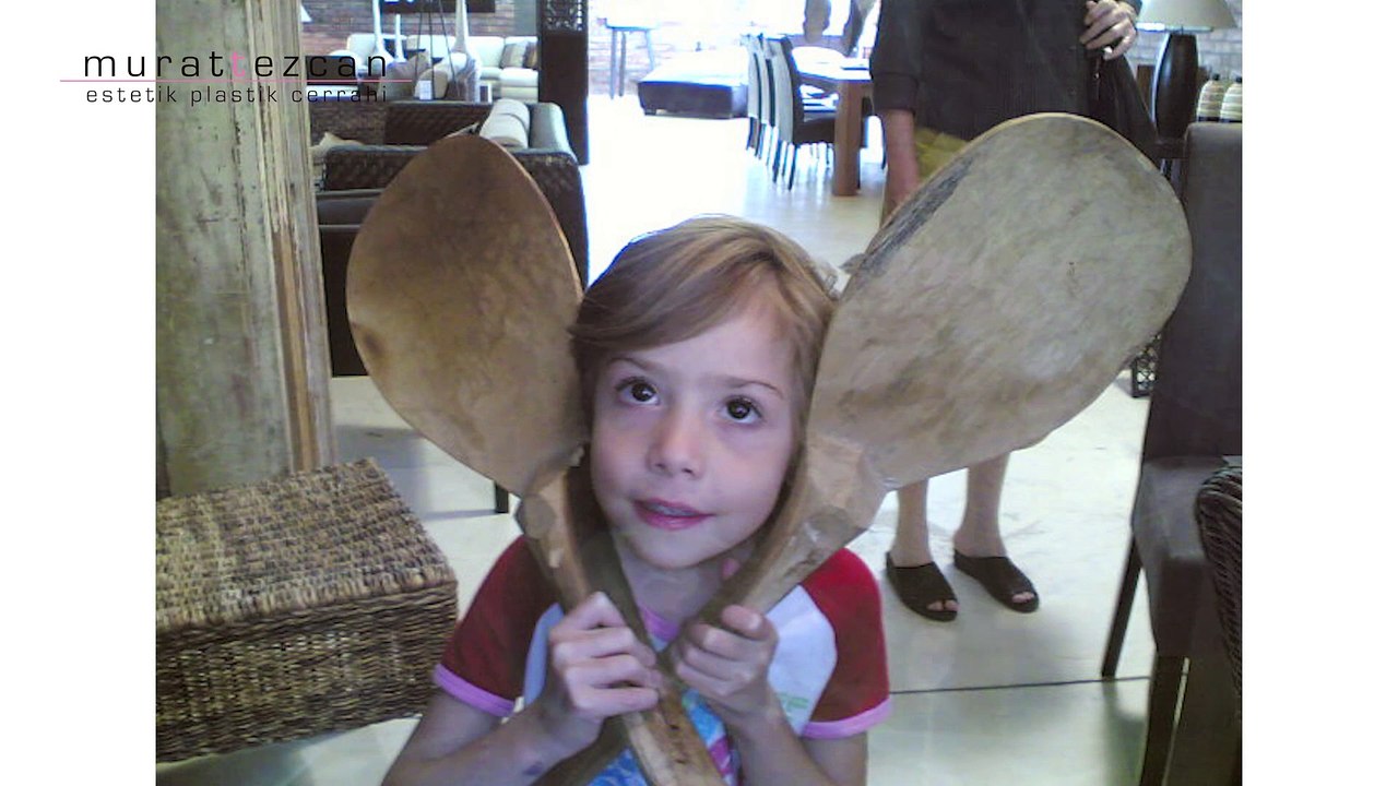 Kepce Kulak Estetiği - Bursa Estetik ( DR. Murat TEZCAN )