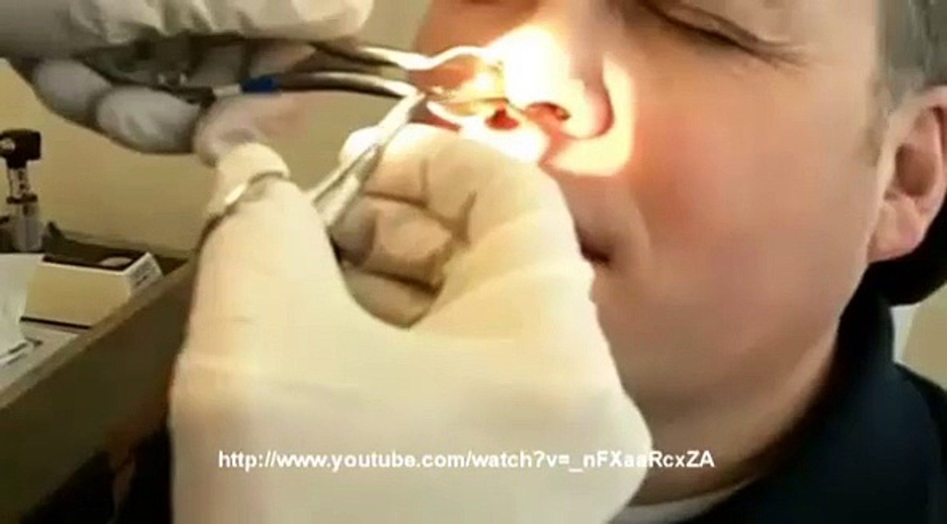 Une Crotte De Nez De Taille Video Dailymotion