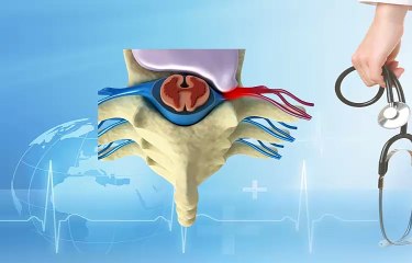 Laser Endoscopic Spine Surgery (LESS)