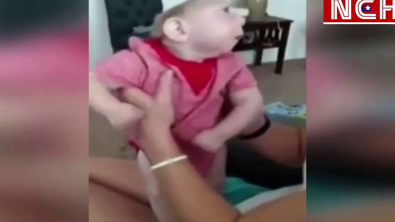 Jaxon, el bebé que nació sin parte del cráneo y cerebro