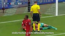 Eduardo Gets Injured in Duel with Gotze - Bayern vs Dinamo Zagreb - Champions League - 29.09.2015