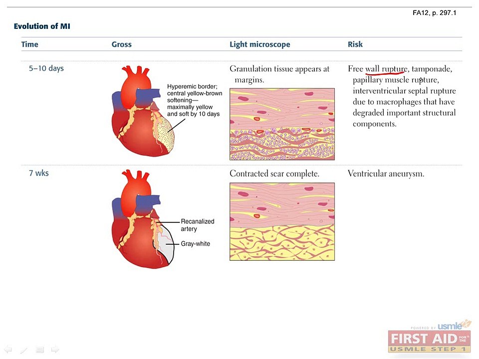 Cardiovascular Pathology Part 2