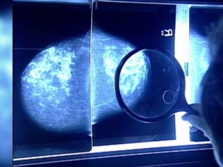 Holding your breath becomes a powerful tool to fighting breast cancer